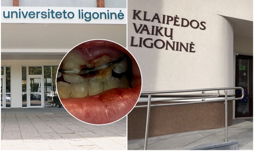 Pagalbos 8-metė nesulaukė ne vienoje iš ligoninių
