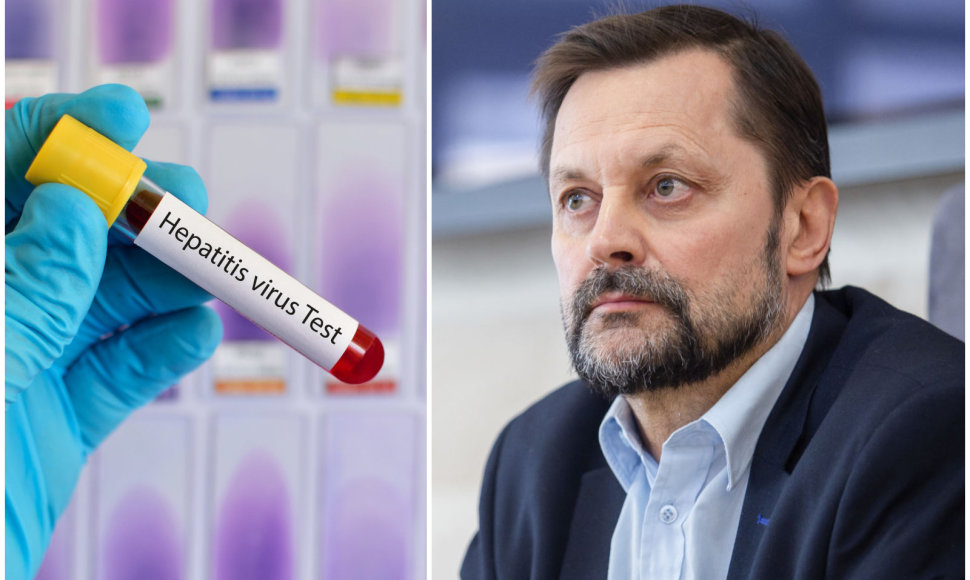 Gastroenterologas Vaidotas Urbonas – apie neaiškios kilmės ūminį vaikų hepatitą