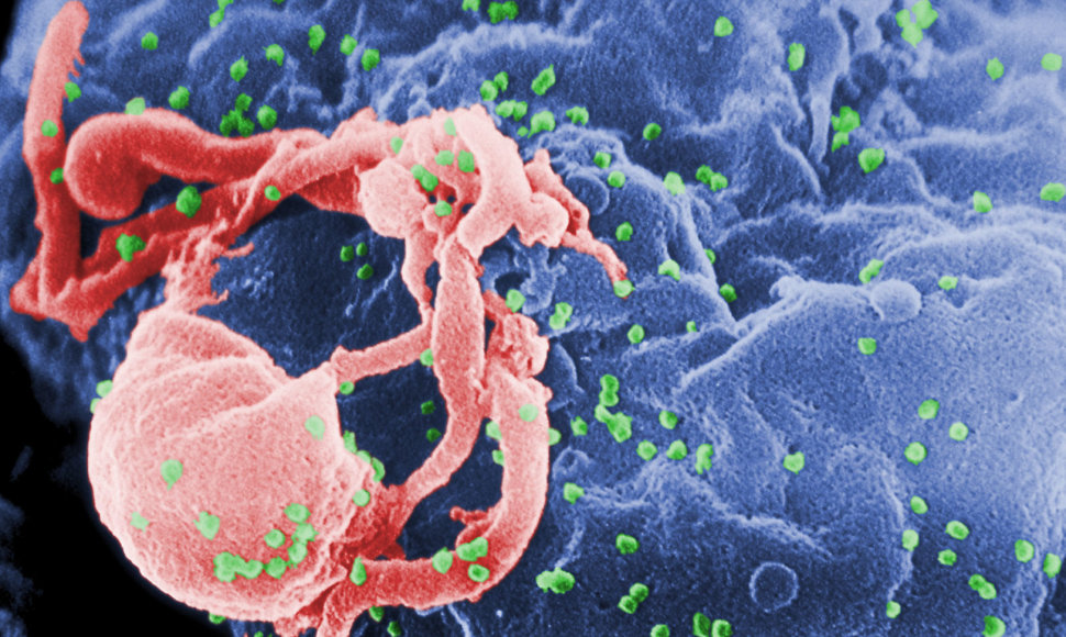 Prie ląstelės paviršiaus prikibęs ŽIV virusas