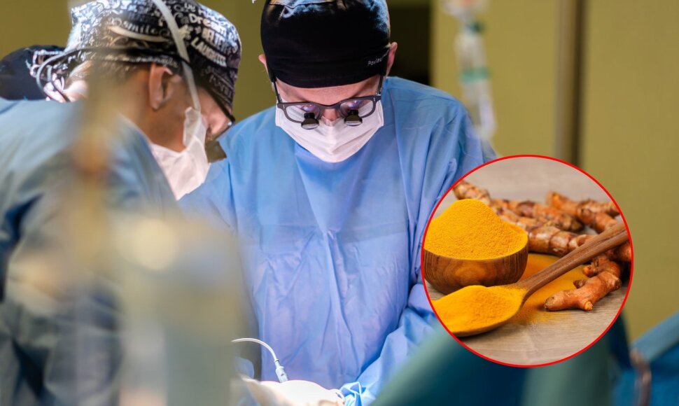 Kepenų transplantacija