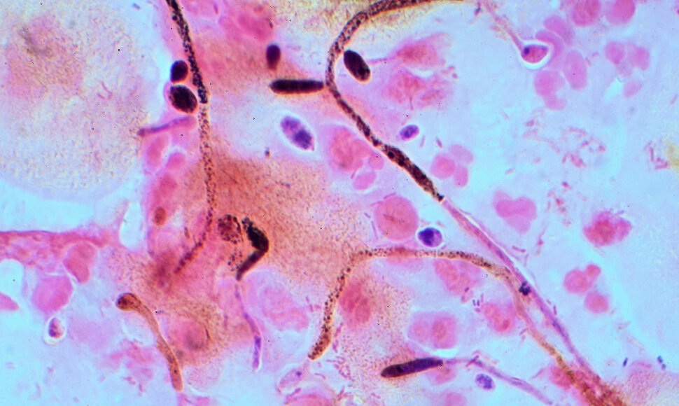 Grybelis Candida albicans