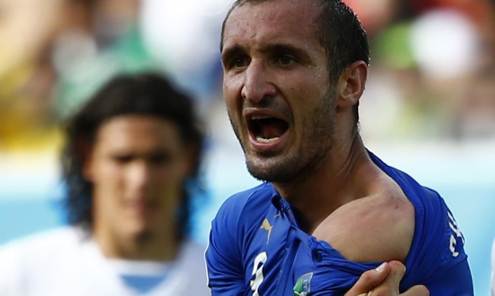 Giorgio Chiellini rodo ant peties likusias Urugvajaus futbolininko Luiso Suarezo kandimo žymes