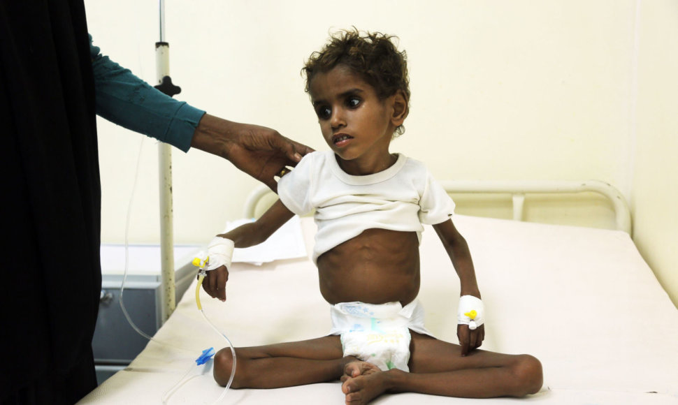 Nuo bado kenčiantis Jemeno gyventojas
