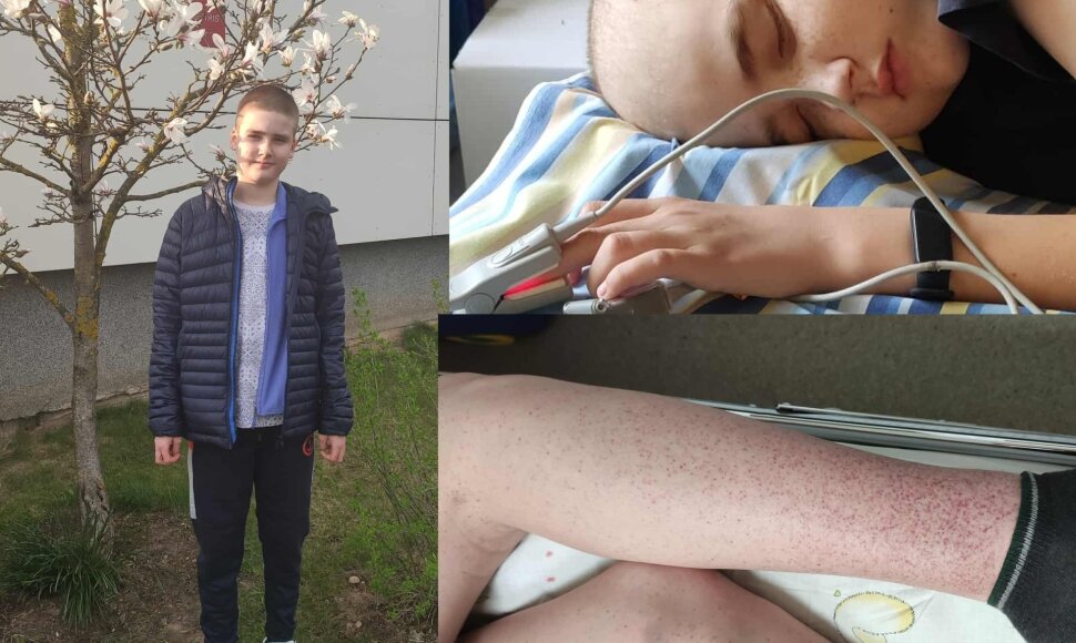 Dovydo sveikimo kelias