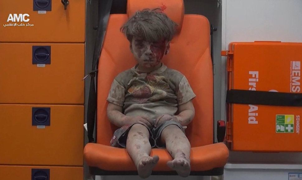 Sužeistas penkiametis Alepe