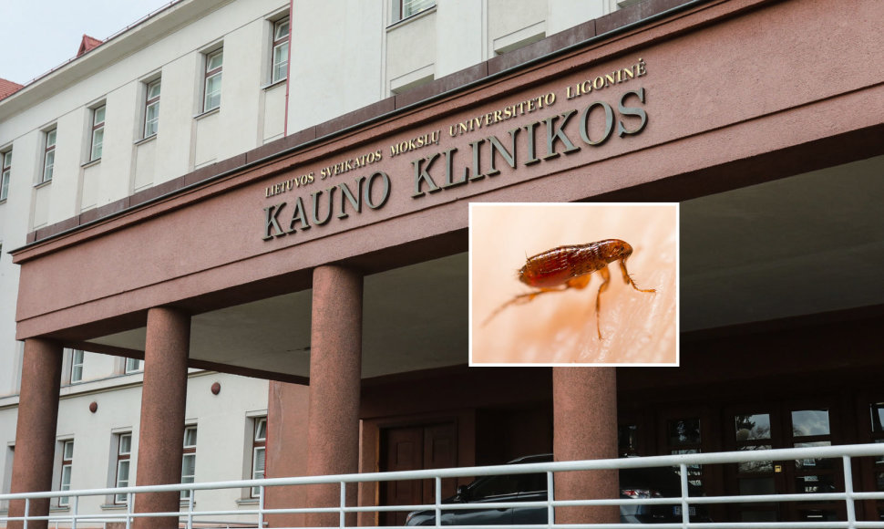 Blusos Kauno klinikinėje ligoninėje