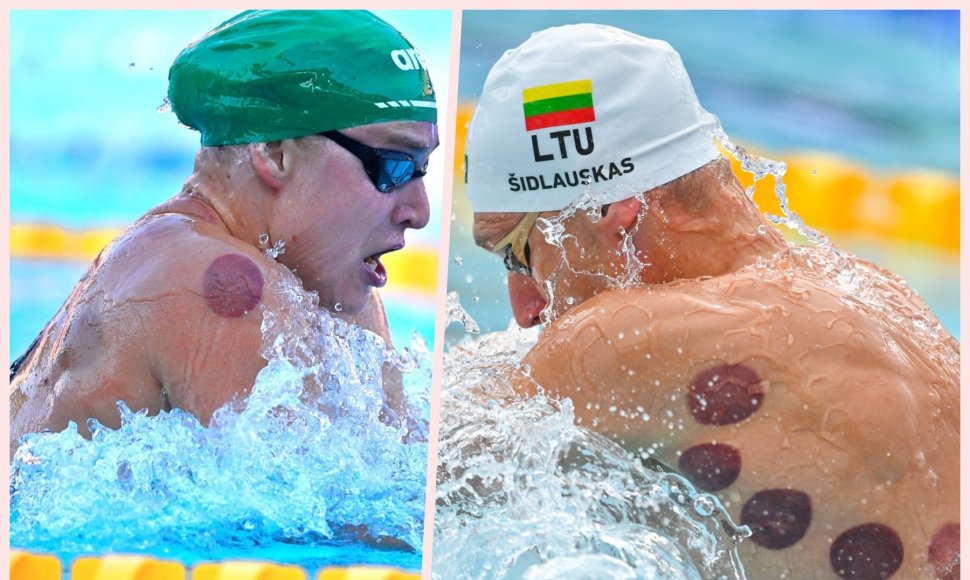 Europos plaukimo čempionate dalies plaukikų, tarp jų Rūtos Meilutytės ir Andriaus Šidlausko, kūnus žymi vaakuminių taurių paliktos žymės. 