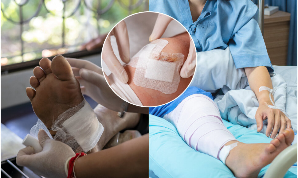 Lietuvoje dėl žaizdų kenčia dešimtys tūkstančių žmonių