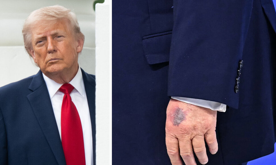 Donaldas Trumpas