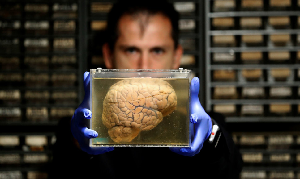 Muziejaus eksponatas – fiksuotos žmogaus smegenys