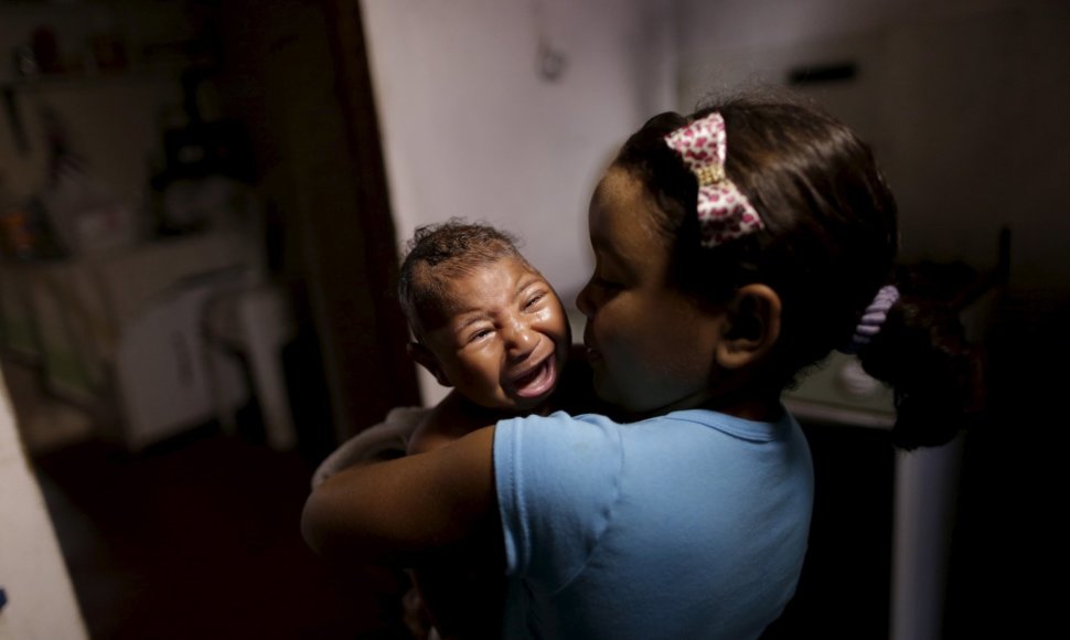 Brazilijoje dėl Zika viruso mikrocefalija sergantis kūdikis