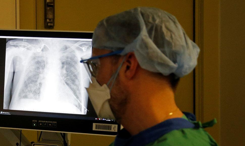 Paciento plaučių rentgenograma
