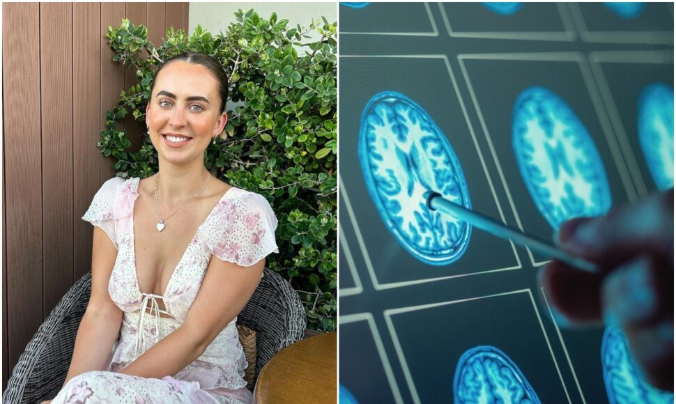 24 metų paramedikei Hannah auglys smegenyse rastas tik po 6 vizitų pas gydytoją
