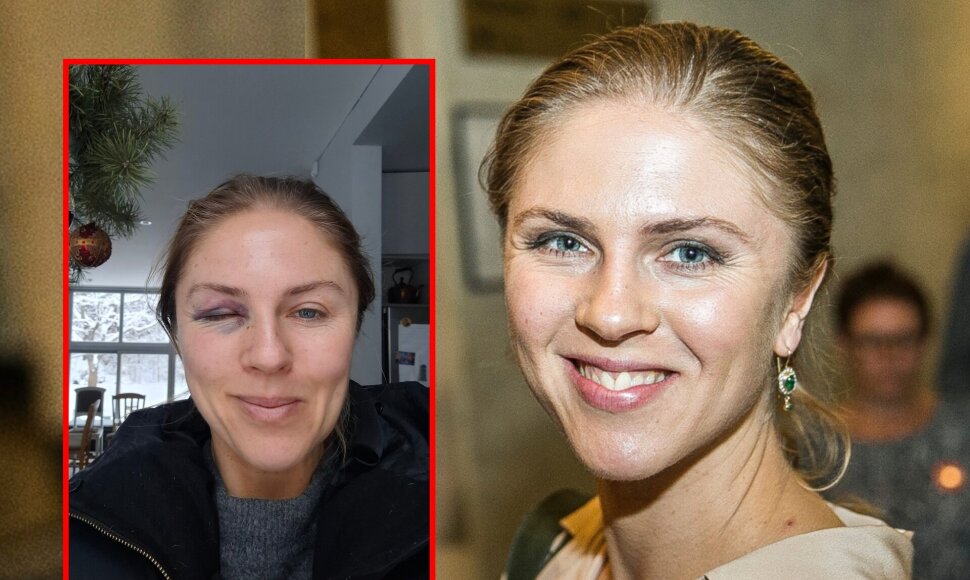 Edita Užaitė