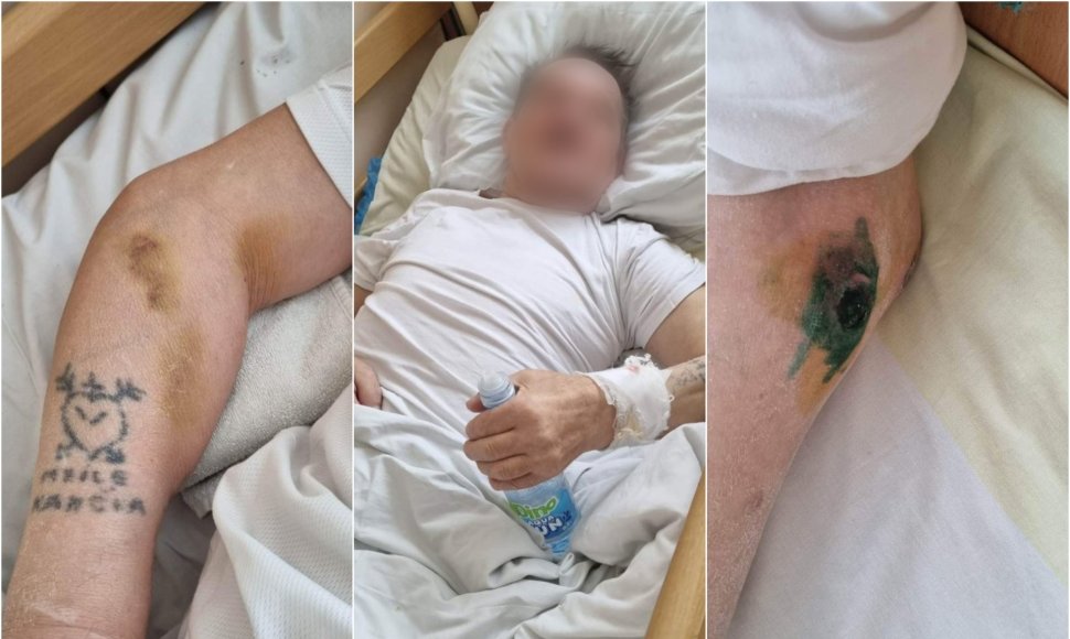72 metų vyras trejus paskutinius savo gyvenimo mėnesius praleido Radviliškio ligoninėje