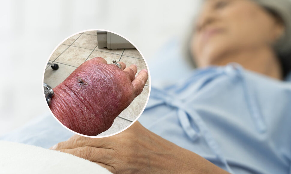 Įsipjovusi ranką popieriumi moteris patyrė ko&scaron;marą