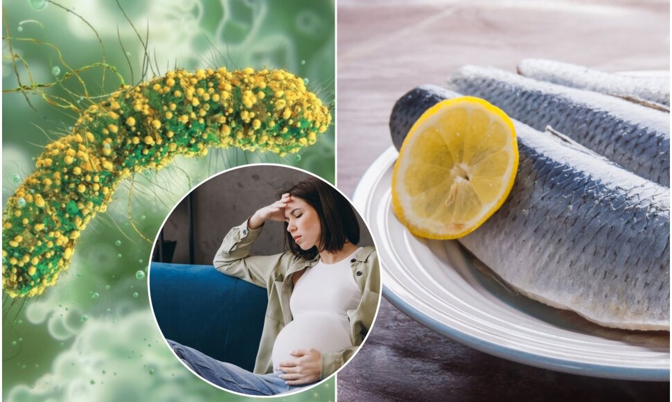 Listeria monocytogenes sukeliama infekcija ypač pavojinga nė&scaron;čiosioms ir naujagimiams
