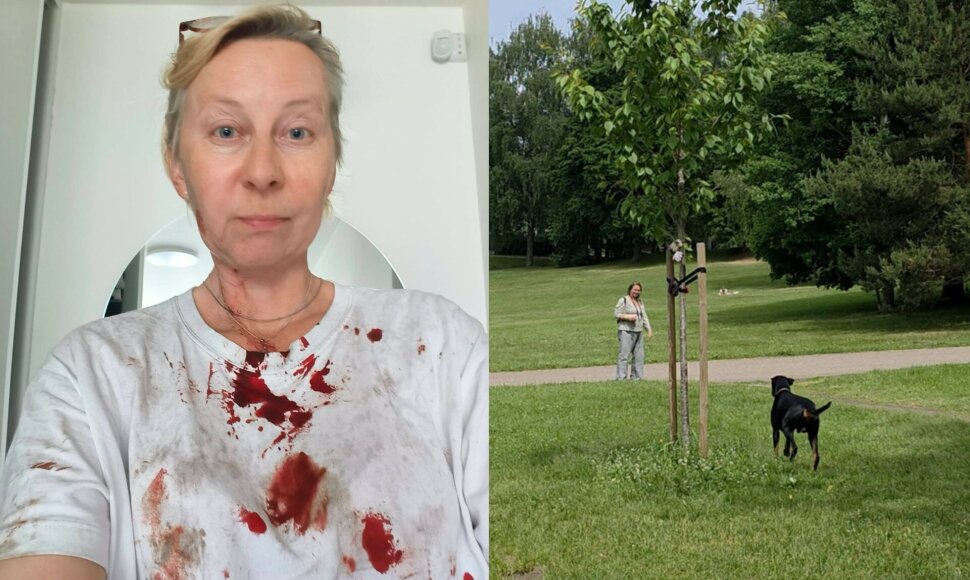 Jurga Varanavičius prabilo apie išpuolį