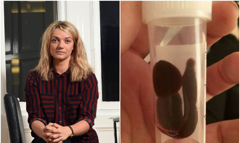 Po kelionės į Aziją Danielos nosyje apsigyveno 7,5 cm ilgio gyvis