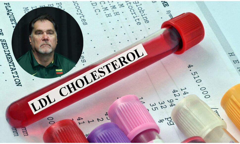 Arvydas Sabonis kviečia reguliariai tikrintis kraujospūdį ir cholesterolio kiekį kraujyje