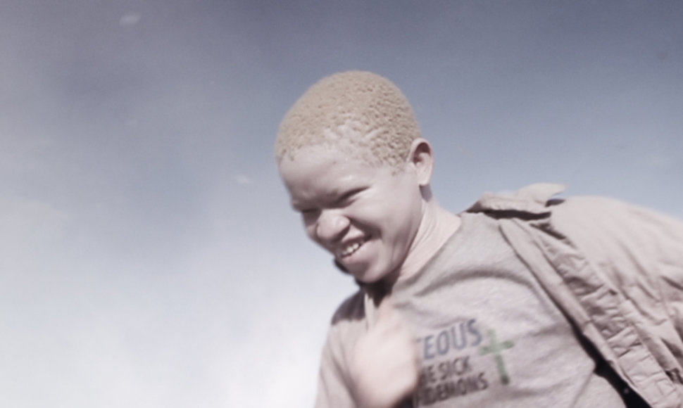 Filmo „Baltas šešėlis“ pagrindinis herojus albinosas Hamisi Bazili.