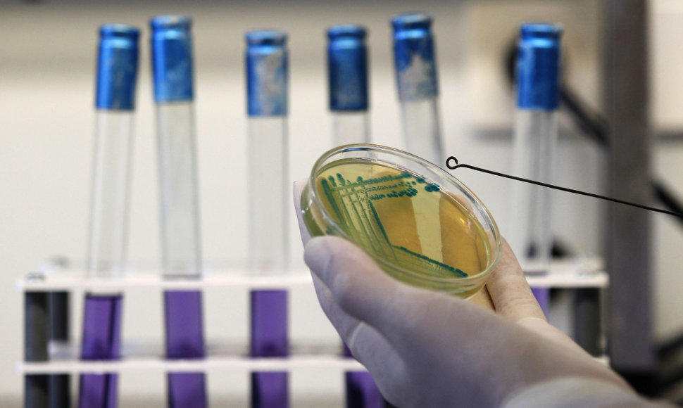 E.coli bakterijos tyrimai