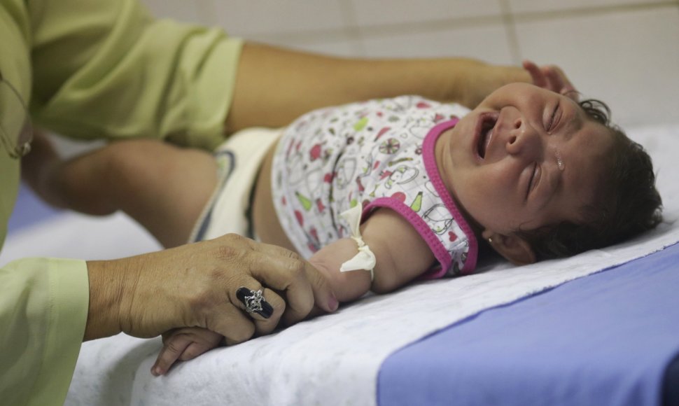 Brazilijoje dėl Zika viruso mikrocefalija sergantis kūdikis