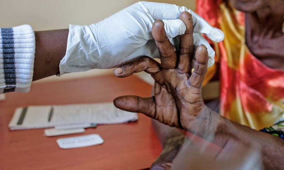 Afrikoje bus išbandyti skiepai nuo maliarijos. 