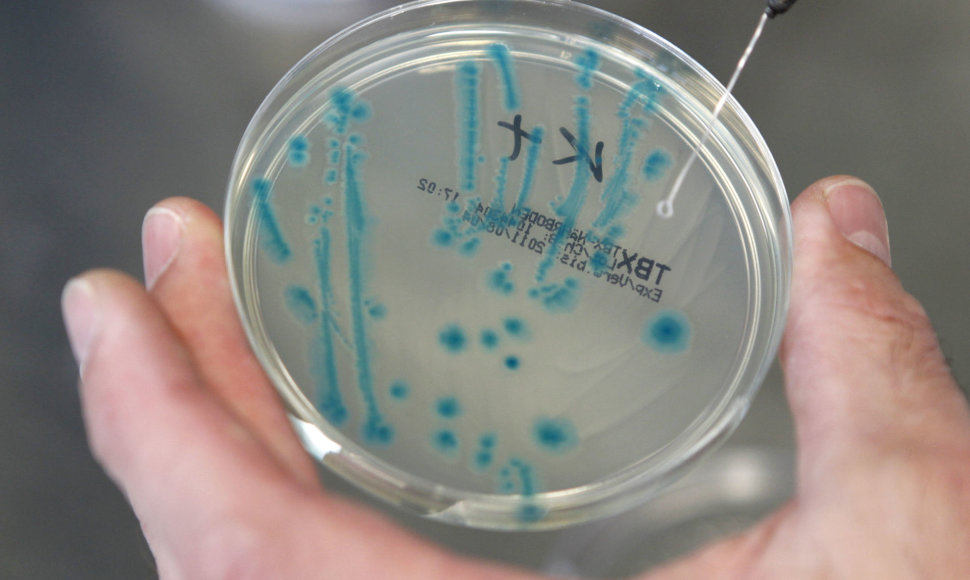 E.coli bakterijos tyrimai