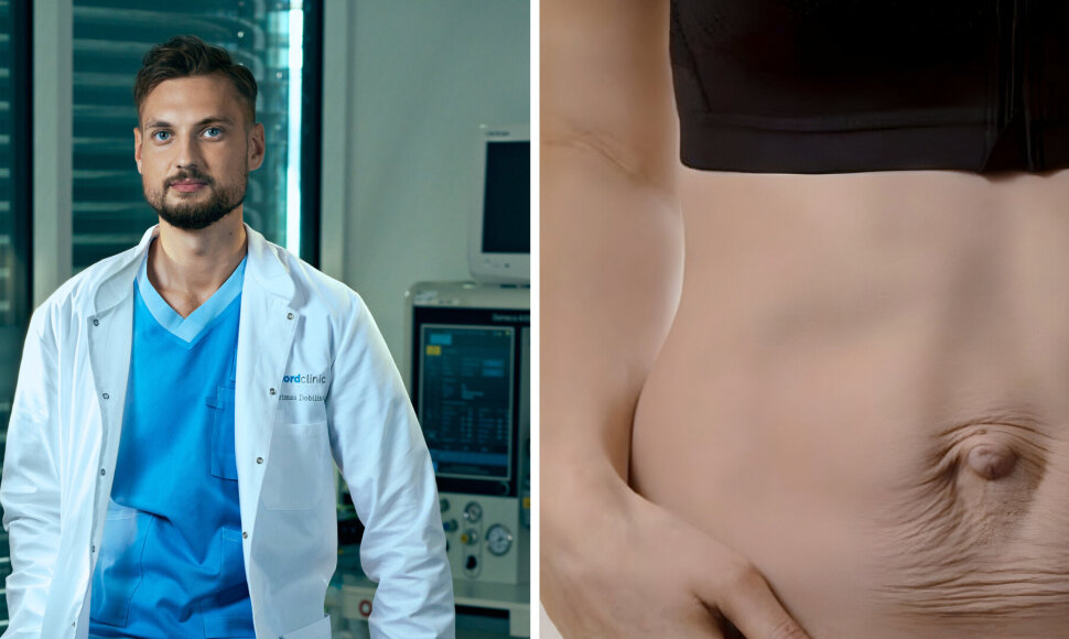 „Nordclinic“ plastikos chirurgas Aurimas Dobilinskas