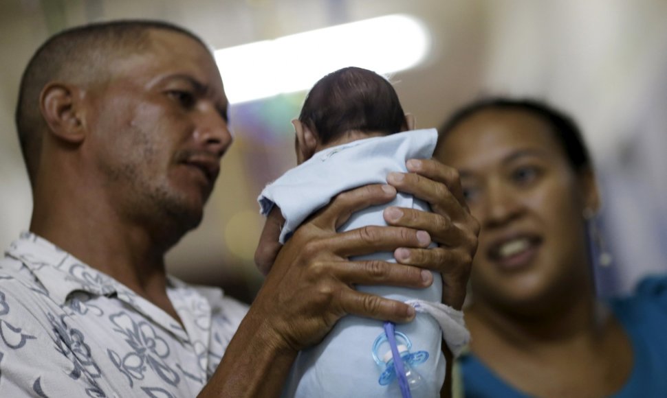 Brazilijoje dėl Zika viruso mikrocefalija sergantis kūdikis