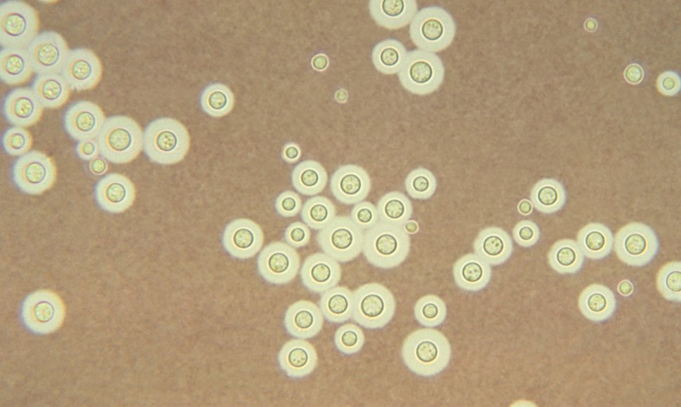 Grybelis Cryptococcus neoformans yra ne tik perspektyvi apsauga nuo jonizuojančios spinduliuotės, bet ir žinoma grėsmė asmenims su nusilpusiu imunitetu