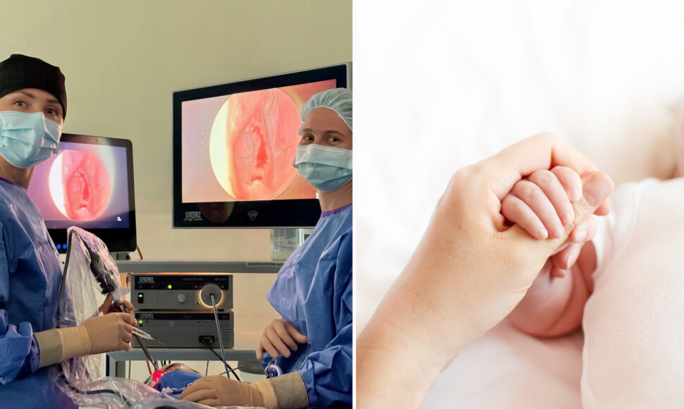 Santaros klinikose 4 dienų kūdikiui atlikta inovatyvi operacija