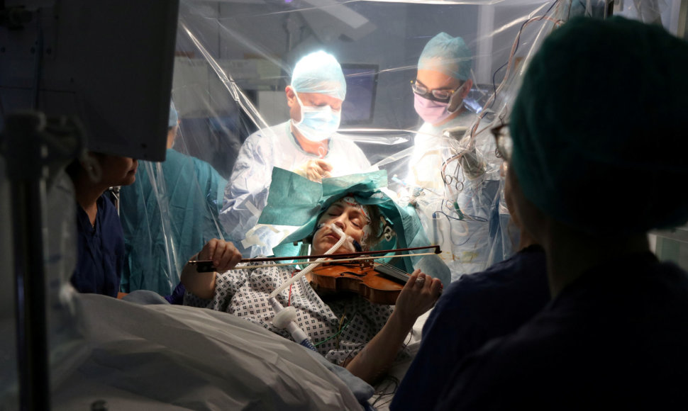 Moteris groja smuiku operacijos metu