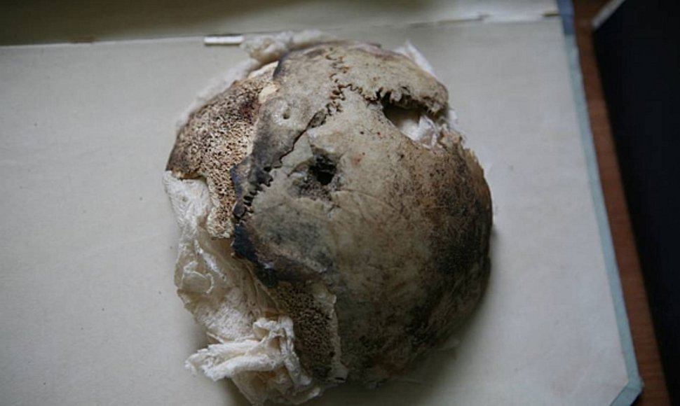 JAV mokslininkai prieš kurį laiką pareiškė, kad Rusijos archyve saugomi kaukolės fragmentai iš tiesų yra moters, o ne Trečiojo reicho vadovo.