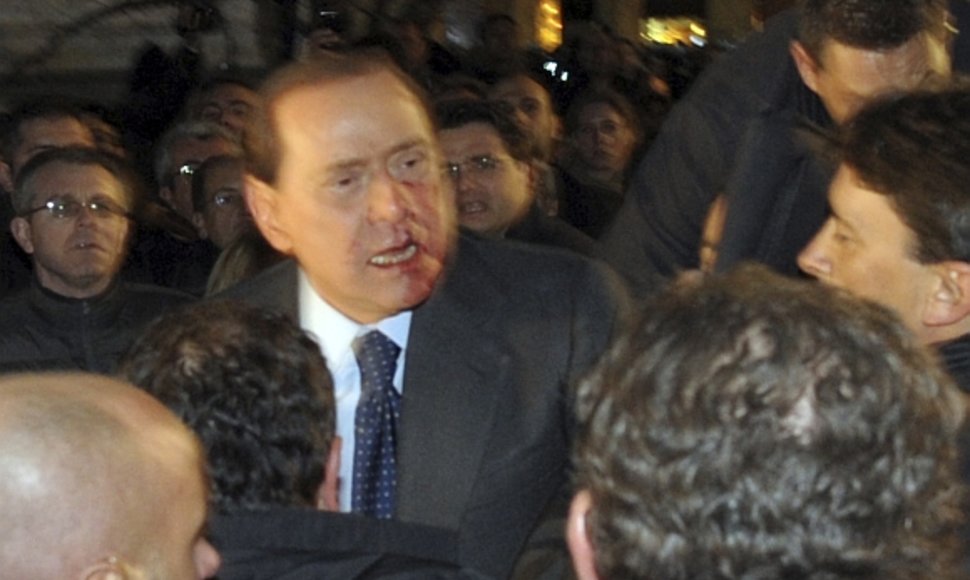 Po smūgio Silvio Berlusconi veidas paplūdo krauju.