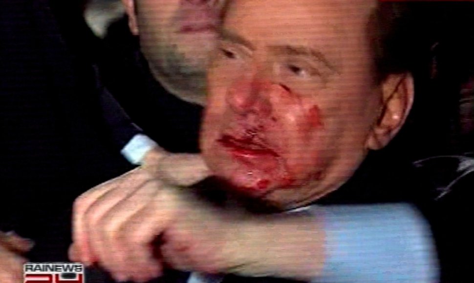 Užpuolikas smarkiai sužalojo Italijos premjero veidą.
