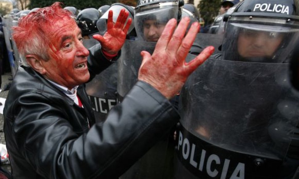 Protesto akcija Tiranoje virto kruvinomis kautynėmis.