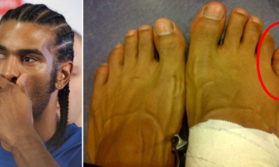 Davidas Haye internete išplatino savo pėdų nuotrauką, kuriame matomas ištinęs pirštas.