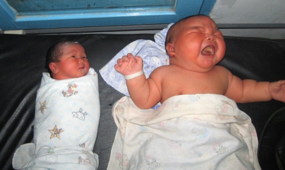 Sunkiausias Indonezijoje gimęs kūdikis, sveriantis 8,7 kg, guli šalia vidutinio dydžio kūdikio.