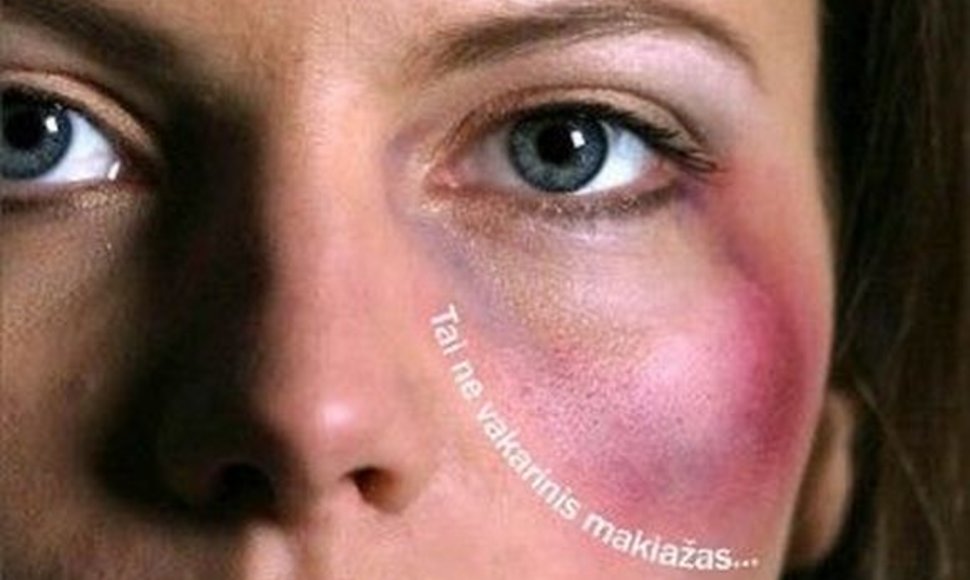 Kauno moterų draugijos kovos su smurtu prieš moteris simbolis - plakatas su sumušta moterimi