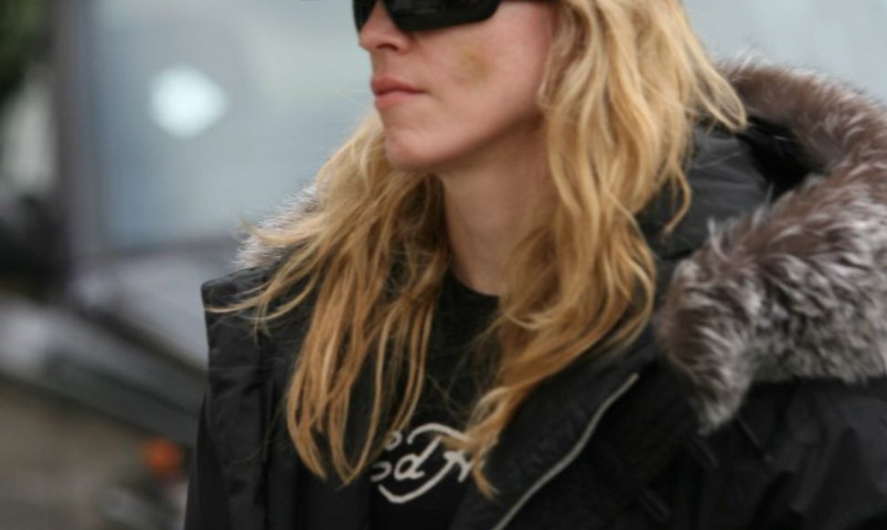 Foto naujienai: Madonna – veido plastinių operacijų įkarštyje?
