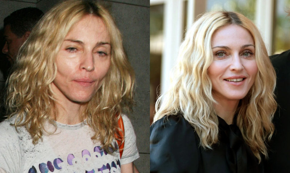 Foto naujienai: Madonna: ką gali plastinės operacijos? 