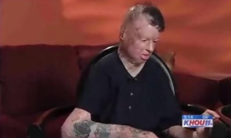 Robbie Middletonas pernai balandį mirė.