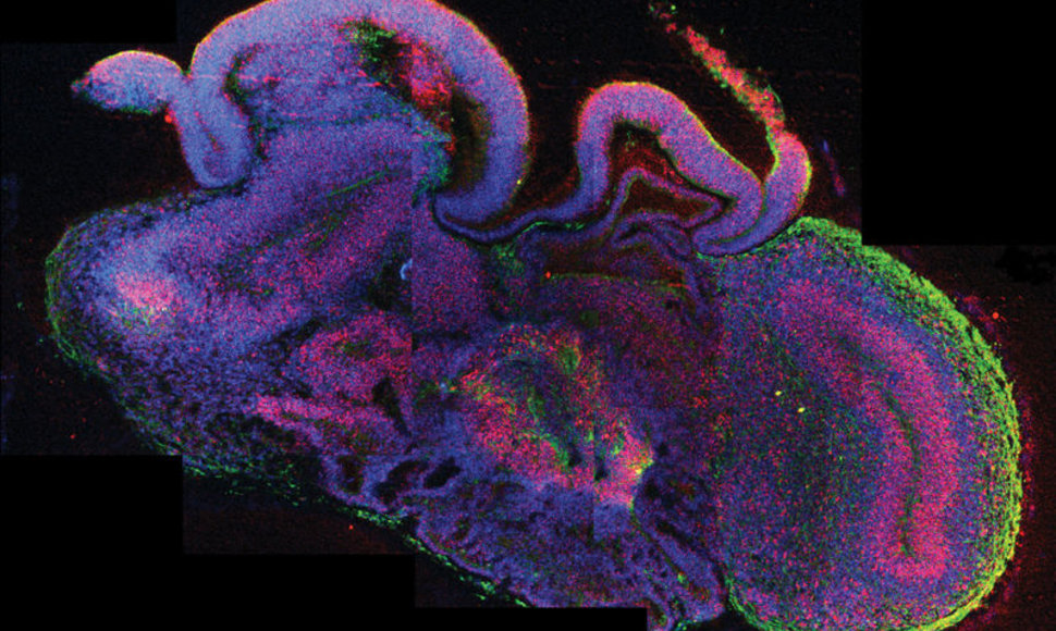 Mokslininkams pavyko laboratorijoje užauginti miniatiūrinės žmogaus smegenis
