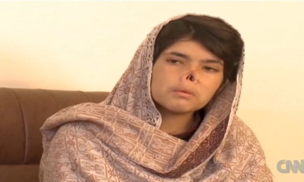 Afganistanietė Bibi Aisha, kuriai už tai, kad ji pabėgo iš savo vyro namų, buvo nupjautos ausys ir nosis