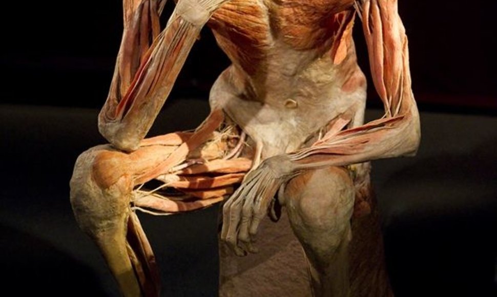 Parodos „The Human Body Exhibition“ eksponatas