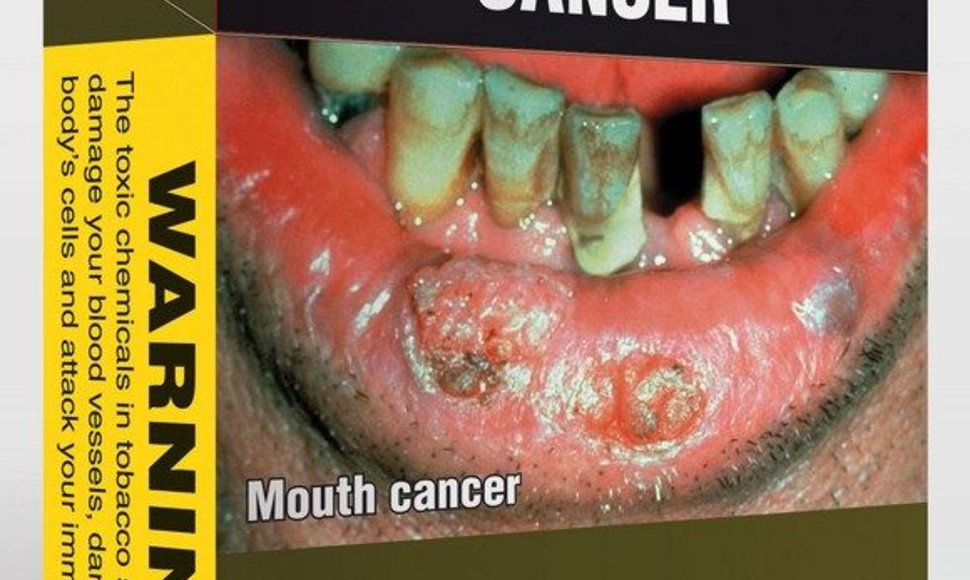 Australijoje pardavinėjami cigarečių pakeliai su perspėjimu „Rūkymas sukelia burnos ir gerklės vėžį“