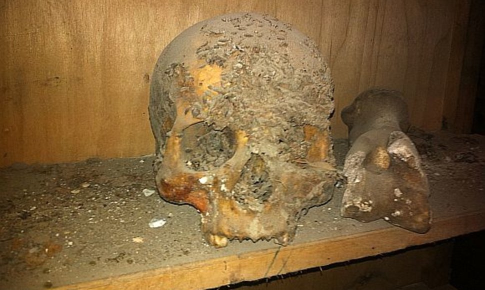 XVIII a. kriptoje palaidoto vilniečio kaukolė.