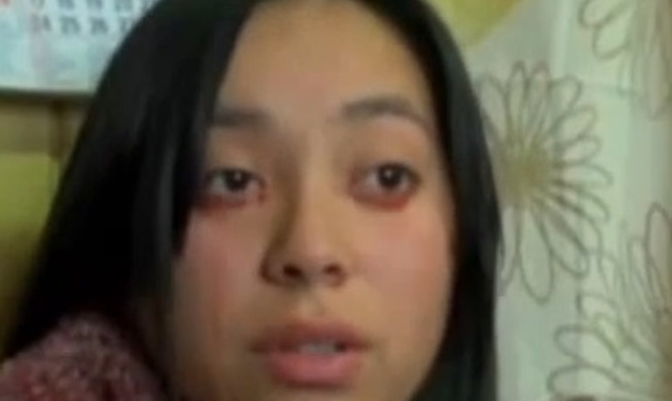 20-metė Yaritza Oliva, gyvenanti Čilėje, verkti kraujo ašaromis pradėjo šio mėnesio pradžioje.